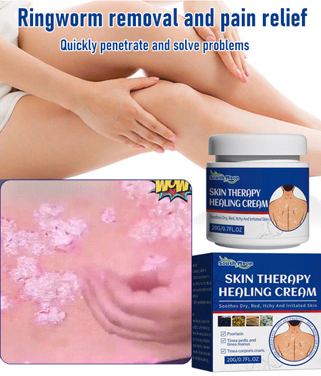 I try it and it really works !Eczema Redness Itching Relief Skin Repair Cream