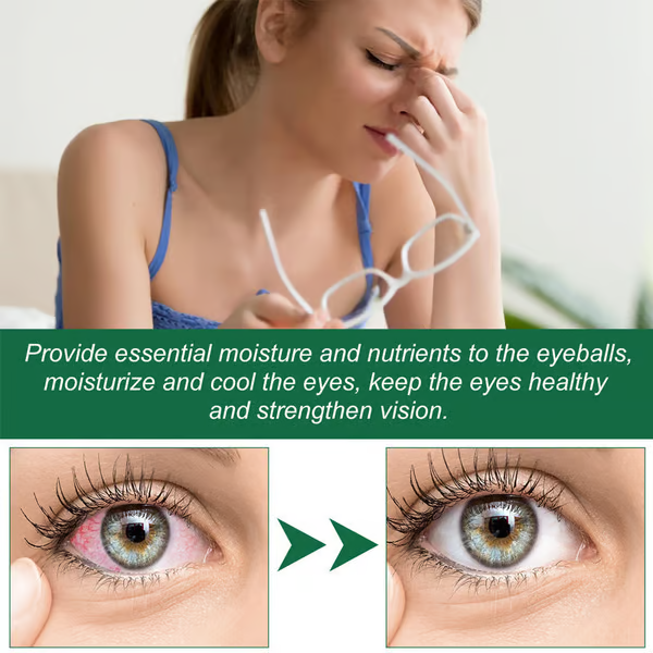 🍀Seurico™ Presbyopia Eye Drops