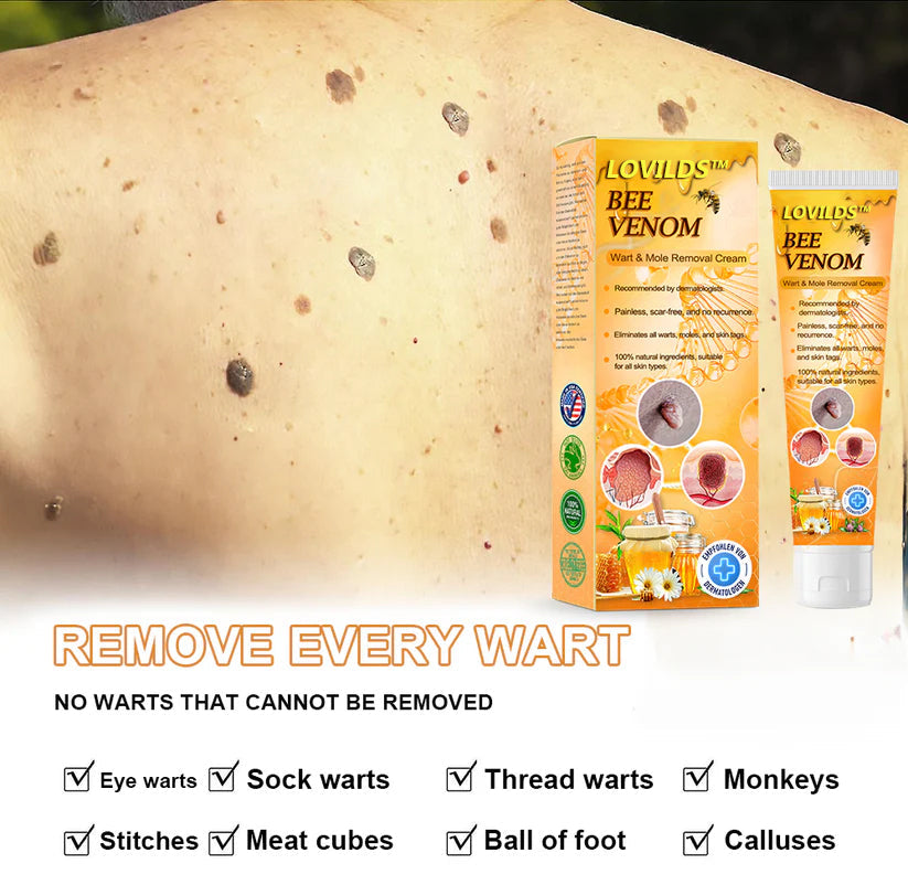 šLOVILDS⢠Bee Venom Wart & Tag Removal Cream(šØāāSuitable for all skin types)š(š„BUY 1 GET 1)