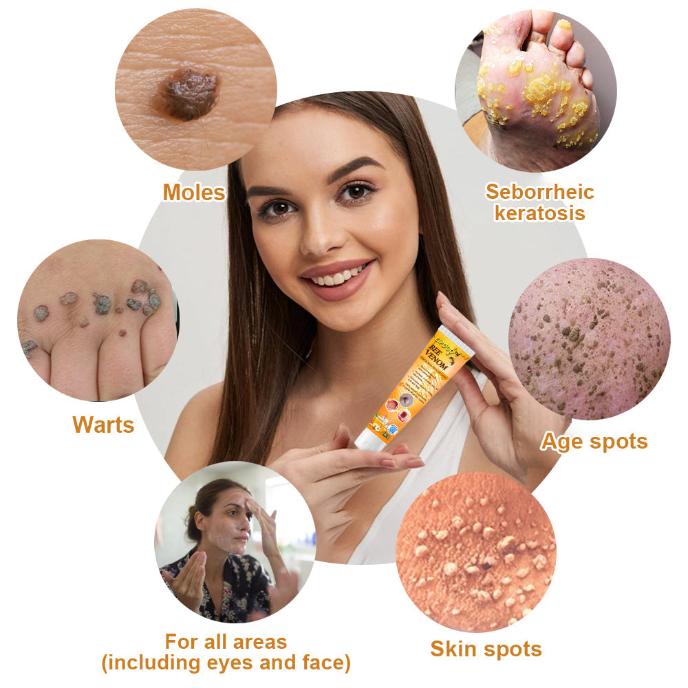 šLOVILDS⢠Bee Venom Wart & Tag Removal Cream(šØāāSuitable for all skin types)š(š„BUY 1 GET 1)