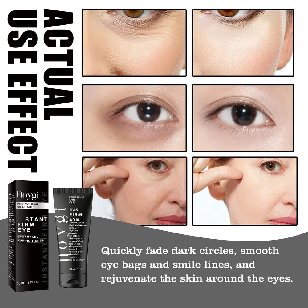 【buy one get one free】🔥Christmas Sale🎁49% OFF!!🔥Eye Tightener