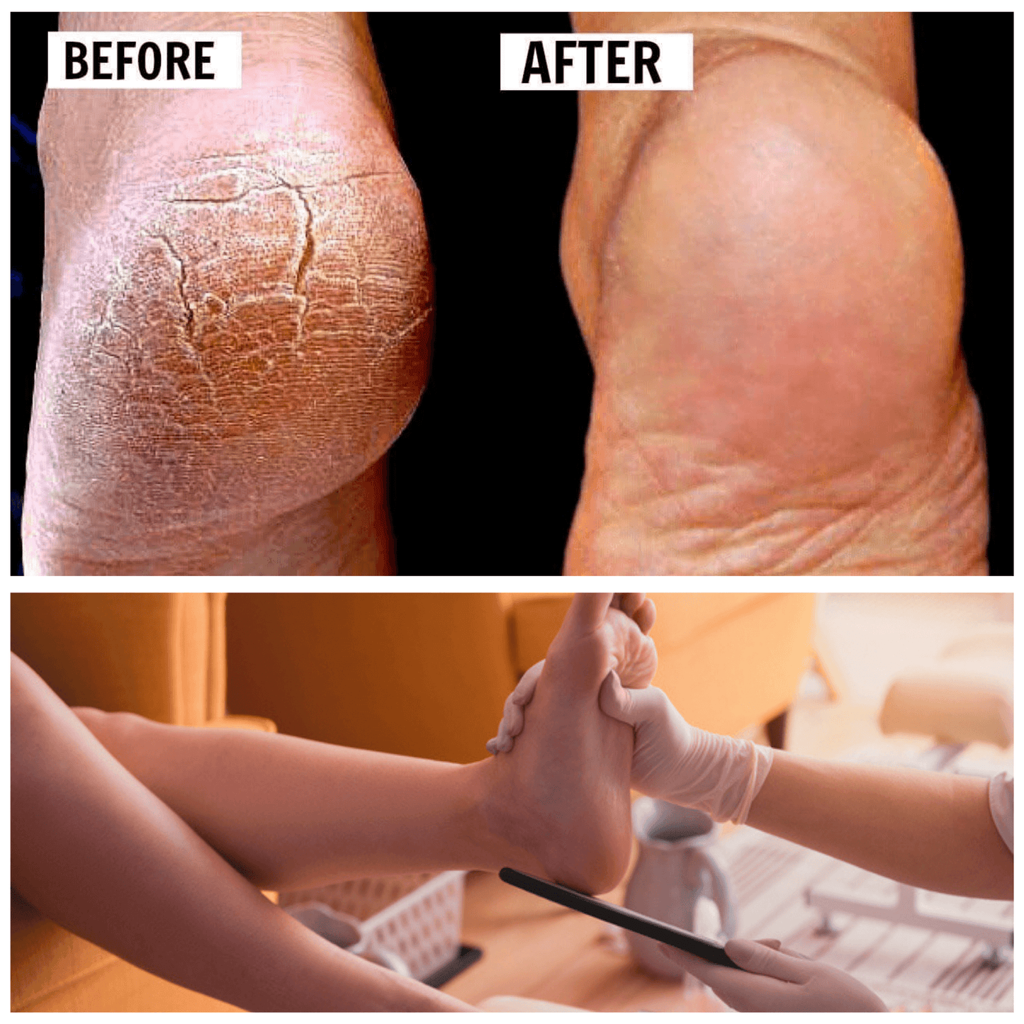 Callus Pro Advanced Eliminator SystemăđCash On Delivery + Local Stock (Express 3 Day Delivery)ă