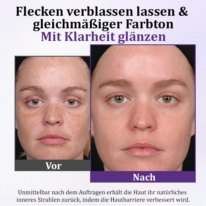 Ceoerty® PigmentaX ProFade anti-hyperpigmentation cream