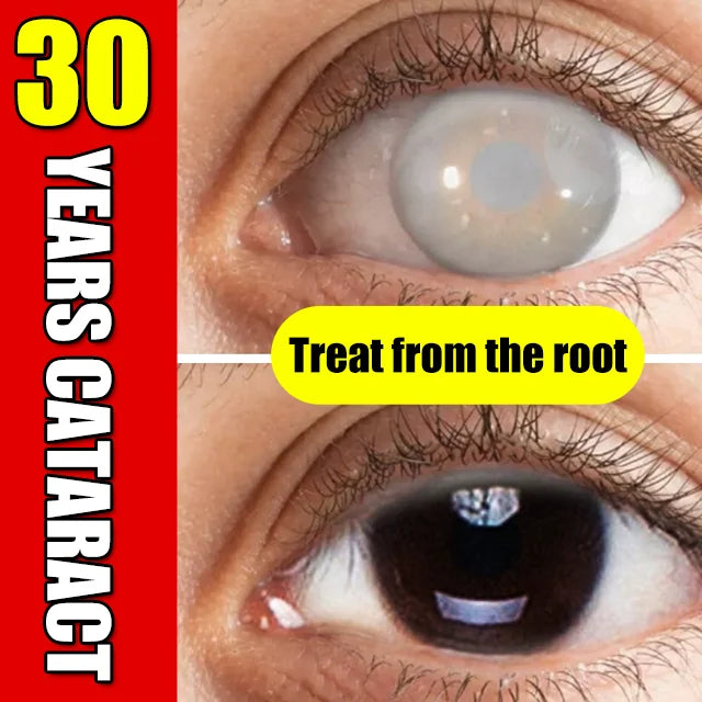 Middle-aged and elderly cataract eye drops