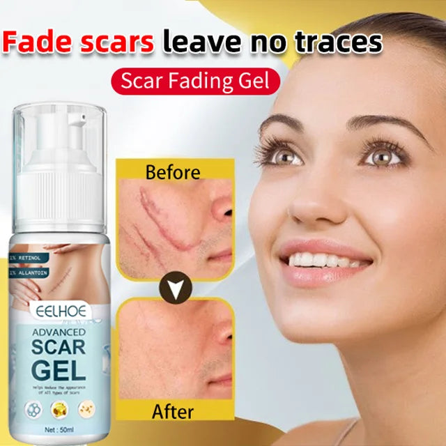 Fading Scars Gel