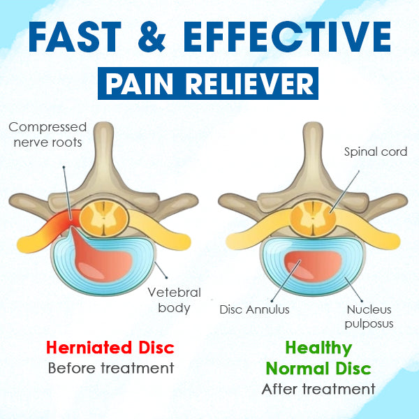 EMSHealth™ Herniated Discs Treatment Device - Sale up to 80% Off Discounts!