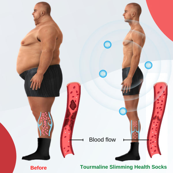 【buy one get one free】(LAST DAY PROMOTION🔥- SAVE 48% OFF) TOURMALINE LYMPHVITY SLIMMING HEALTH SOCK