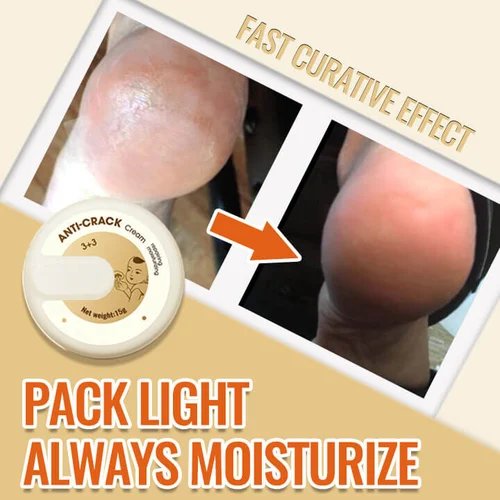 🔥2022 Hot Sell（ 45% OFF)🔥Natural Anti-Cracking Frost