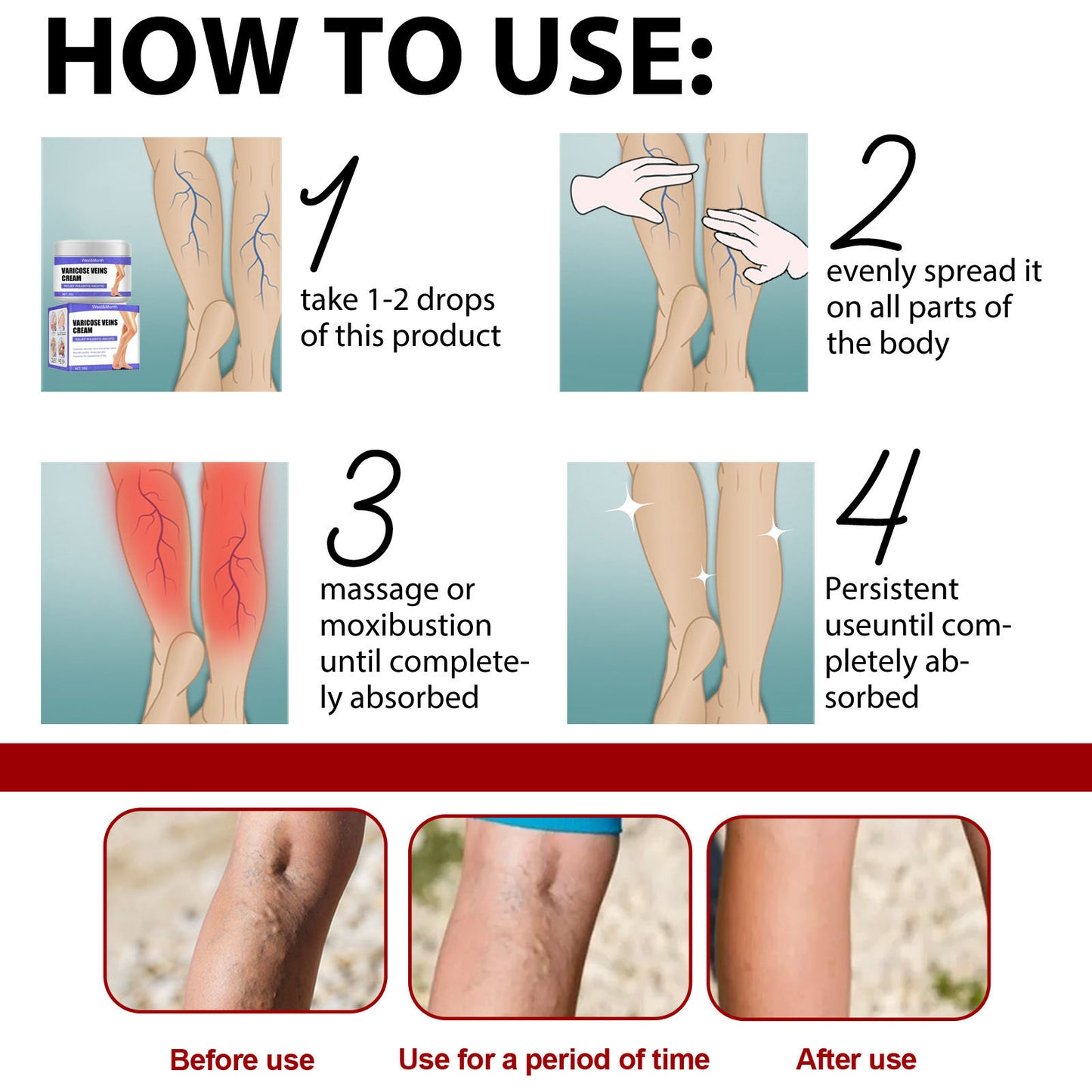 varicose veins, promoting blood【Varicose Vein Cream】